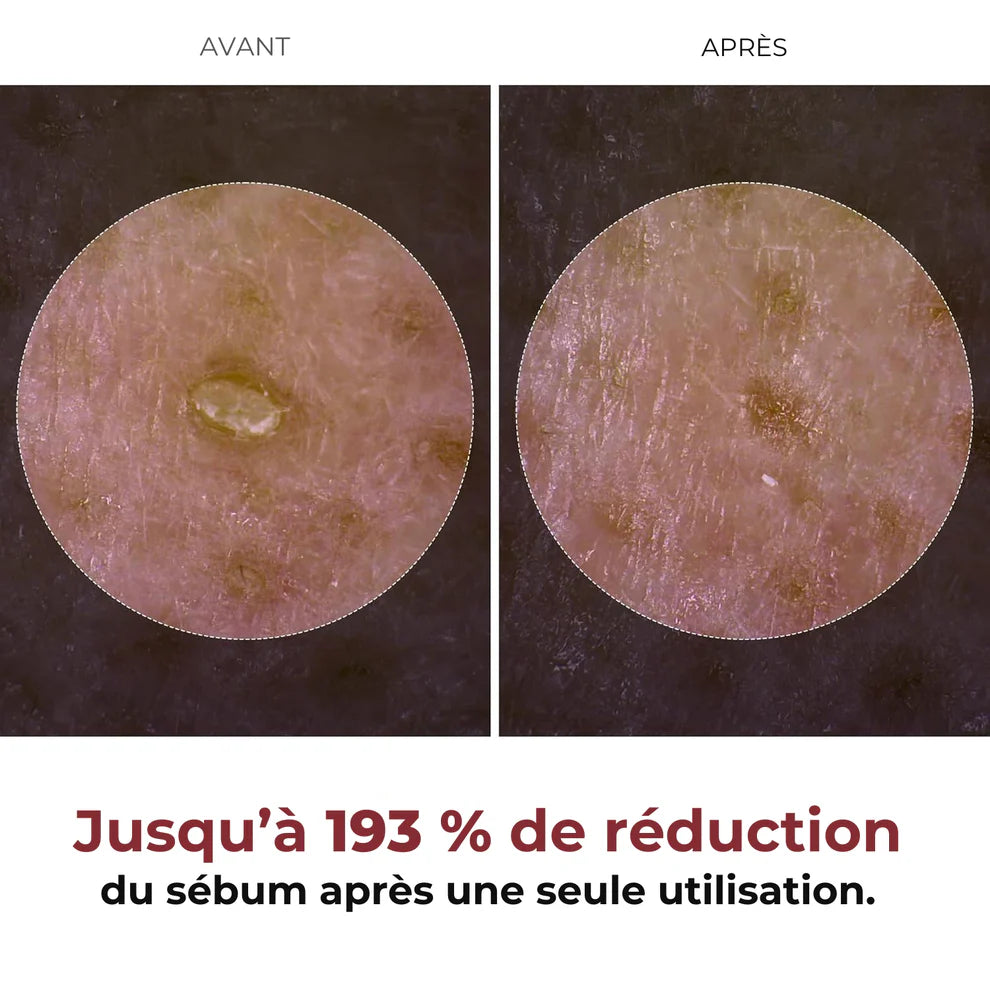 Dr.Melaxin PEEL SHOT BLANC – Sérum Exfoliant & Pureté