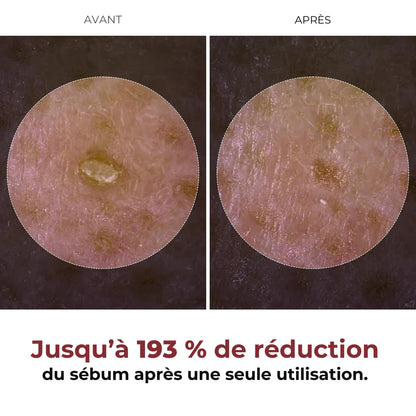 Dr.Melaxin PEEL SHOT BLANC – Sérum Exfoliant & Pureté